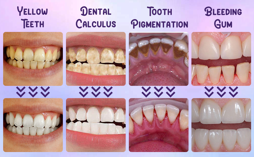 Teeth Restoration Mineral Powder
